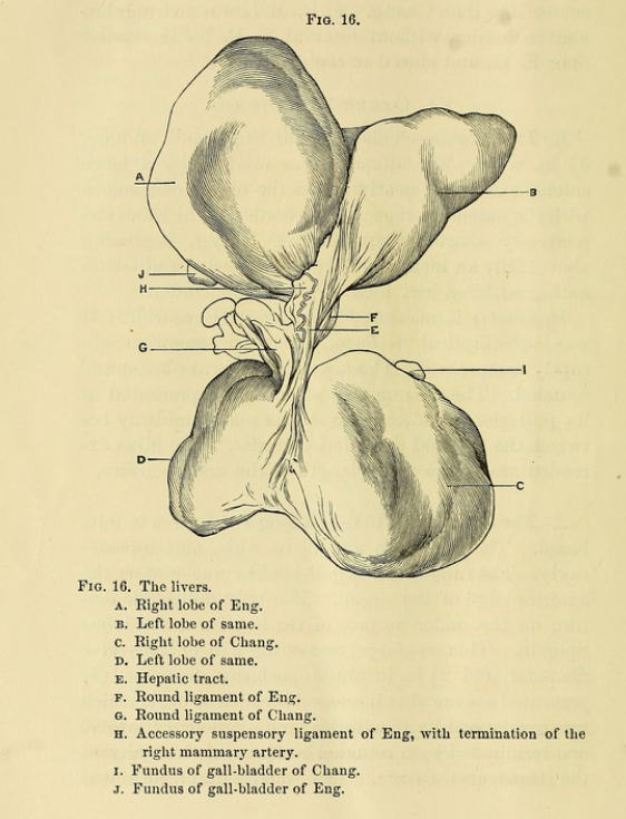 autopsy3 foies.png