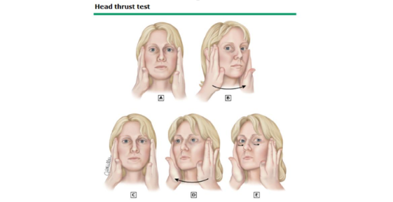 head thrust test .png